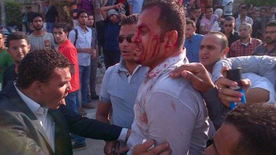 بالصور ..أكثر من 10 اصابات في اشتباكات طلاب الإخوان والمستقلين بجامعة القاهرة