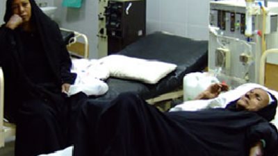 دراسة بجامعة اسيوط..الرجال والعمال الحرفيين والاميين هم اكثر الأفراد عرضة لمرض الفشل الكلوى