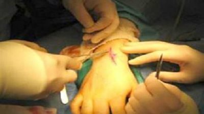 جامعة سوهاج تنظم المؤتمر الرابع لجراحات اليد بمدينة الغردقة