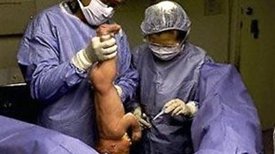 بالفيديو ..ميكانيكي يبتكر أسهل طريقة للولادة