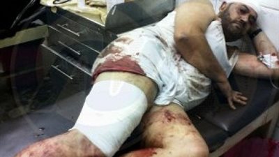 بالفيديو والصور .. طلاب الإخوان يطعنون موظف بجامعه المنصورة ويحرقون سيارة شرطة
