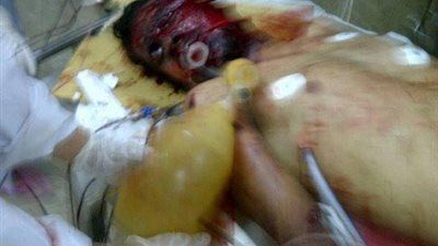 محافظ الدقهلية ..8 شهداء و85 مصابا في تفيجيرات مديرية الامن