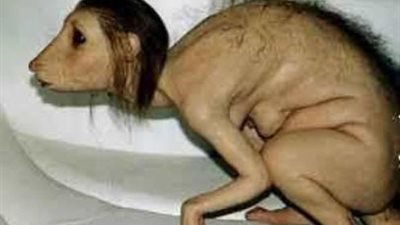 حقيقة الطالبة العمانية الممسوخة