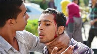 إصابة 13 طالبا من جامعة الزقازيق في اشتباكات طلاب الاخوان مع مستقلين