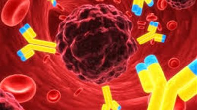 تقرير عالمى يؤكد تنامى معدل الاصابة بمرض السرطان خلال العقدين القادمين