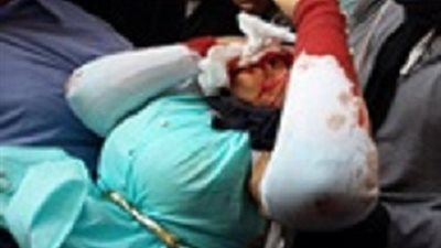 نقل طالبتين بجامعة القاهرة للقصر العيني بعدإصابتهما بالخرطوش