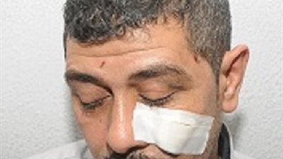 بلطجي بدرجة معلم بمدرسة في بولاق يخلع ملابسه لأم تلميذ ويشوه وجه والده