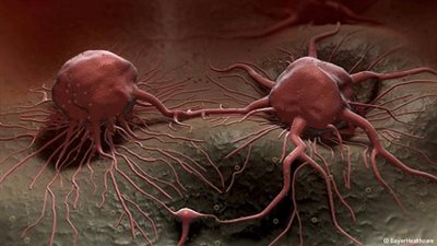 علماء روس يكتشفون فيروسا يقضي على السرطان