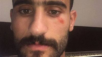 نجاة باسم مرسى من حادث مروع بأكتوبر.. وينشر أول صورة له بعد الحادث