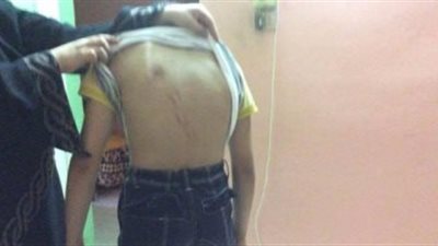 ولى امر يحرر محضرا لمدرسة بعد ضرب نجلة بالخرطوم