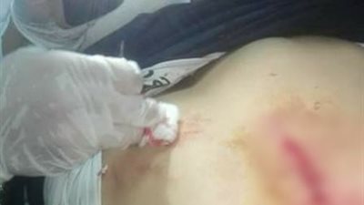 التعليم: استبعاد مدير مدرسة بعد الاعتداء على طالب بالسلاح الابيض