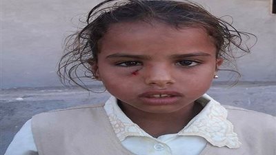 لماذا اعتذر وكيل تعليم مطروح لهذه التلميذة؟