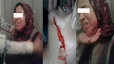 بالفيديو.. تلميذ يشوه وجه معلمته بالسكين