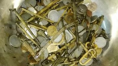 مسامير وسلاسل وعملات معدنية داخل بطن سائق  !!