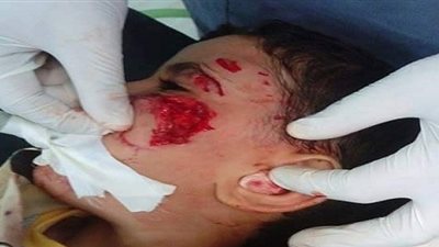 بالصور.. جريمة بشعة تهز  مدارس