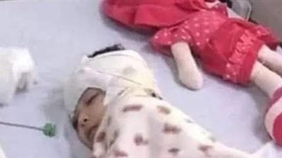 بعد اغتصابها وبتر ساقها.. وفاة الطفلة ضحية تعذيب جدتها