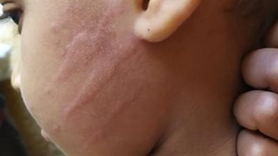 استبعاد مدرس لصفعه تلميذ إبتدئي على الوجه بسوهاج