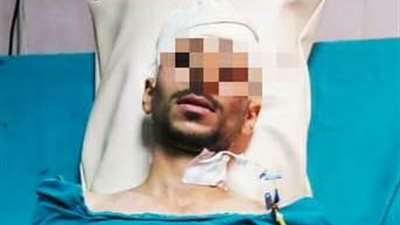  مستشفي سوهاج  الجامعي تنقذ شاب من طعنة قاتلة وتواصل دورها في ظل اجراءات التصدي لكورونا