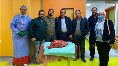 جامعة اسيوط : استئصال ورم خبيث من مريض يزن 30 كيلو 