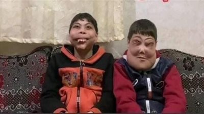 نفسهم يتعالجوا.. أطفال المرض النادر يناشدون الحكومة مساعدتهم 