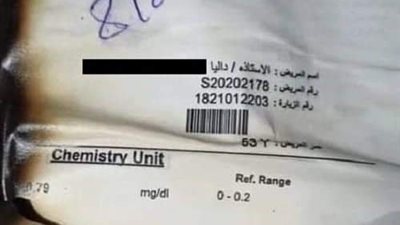 فيديو ..نكشف القصة الكاملة انتحار فتاة حادث الجلالة المرعب.. ورقة طبية  دخل سيارتها تزيد غموض الواقعة