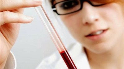 دراسة علمية ..الكوليسترول يهدد حياة الامريكيين