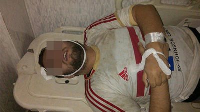 الطب الشرعي يكشف حقيقة مقتل مشجعي الزمالك بطلقات نارية