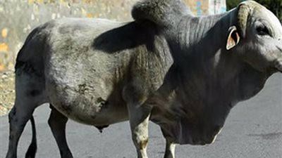 شاهد..الأطباء يستخرجون 20 كيلو جرام