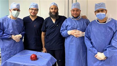 إستخراج فوطة جراحية مهملة في بطن مريض بمستشفيات جامعة المنوفية