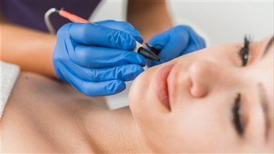 إزالة الشعر بواسطة قطب كهربائى للأبد 