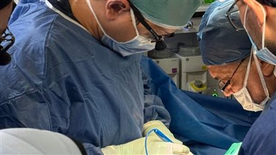 فريق طبي بمستشفى الأطفال في جامعة أسيوط ينجح فى إجراء عملية فصل توأم ملتصق