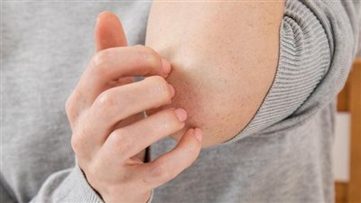 نصائح تحميك من حساسية الجلد في الشتاء