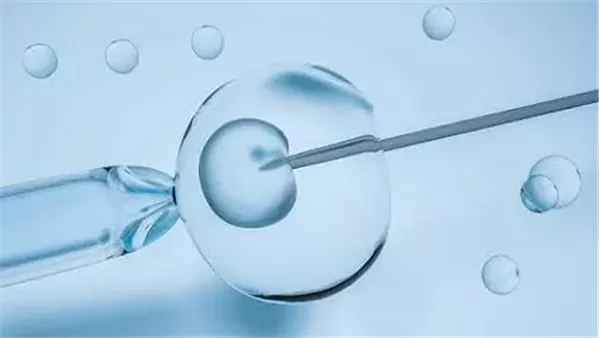 مراحل الحقن المجهري