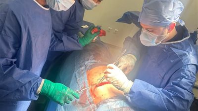 مستشفى بنها الجامعي تنقذ حياة مريضة تعاني من ضيق بالشرايين التاجية