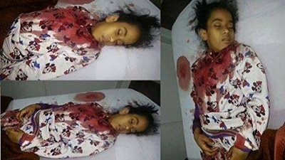 بالصور ..طالبة دخلت لاجراء عملية 