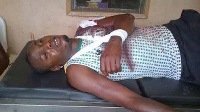 هجوم مسلح وإصابات بالجملة فى صفوف فريف كانو بيلارس النيجيري