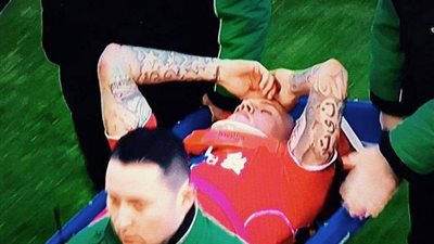 فيديو.. إصابة خطيرة للغاية لـ