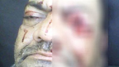 فصل طالب بالاسكندرية فقأ عين مدرسه