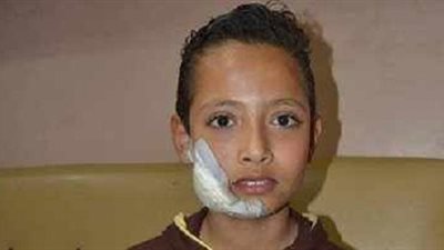 بالصور.. مشاجرة بالمطاوي و السكاكين بين طلاب مدرستين بالسويس