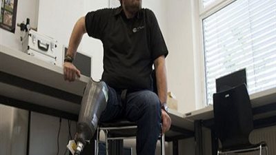 طفرة طبية جديدة.. ساق صناعية تنقل أحاسيس الساق الحقيقية