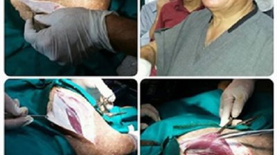 ورشة عمل لطلاب جامعة بنها لارتقاء بمهارتهم لاجراء العمليات الجراحية
