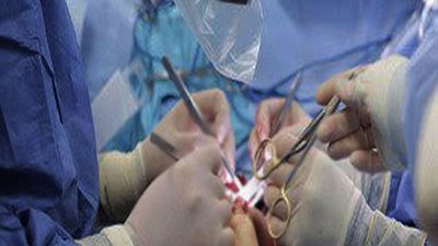 المعهد القومى بالمنوفية يجري زراعة كبد ناجحة لـ