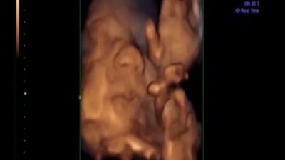 بالفيديو ..جنين يغني وهو داخل بطن امه.. 