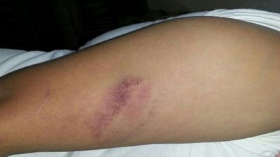 قسم شرطة حدائق القبة يجبر معلم اعتدي عليه طالب ومزق ملابسه وسب له الدين علي التنازل عن المحضر