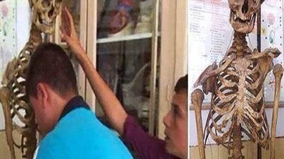 بالصور| مدير مدرسة يبرع بهيكله العظمي للاستخدام فى حصص الأحياء !!