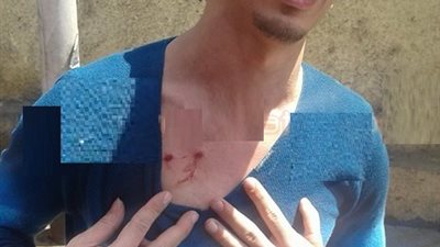 بالصور | إصابات في فض تظاهرات «تيران وصنافير» بالجيزة