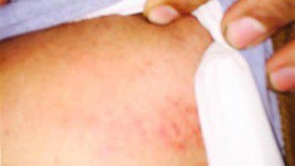 صورة ارشيفية 