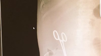 مفاجأة مدوية.. السلطات السعودية تتحفظ على طبيب مصرى ترك 