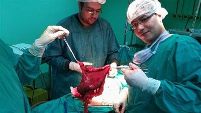   أول حالة استئصال ورم غير حميد بالمعدة والغدد الليمفاوية بجامعة المنوفية 