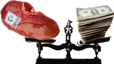 مستشفى السلام الدولي متهمة بالإتجار فى 